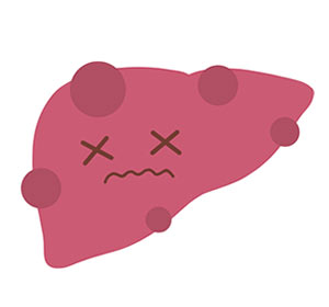 肝繊維化