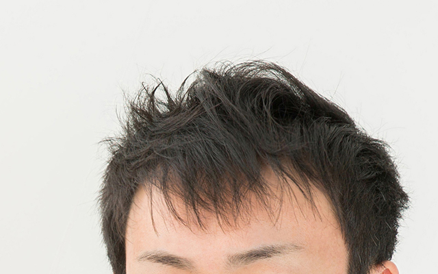 AGA（男性型脱毛症）イメージ